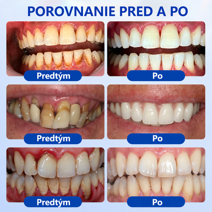 🇪🇺🏅🦷🛡️Evolvion® GumRevive Gél na periodontálnu opravu
