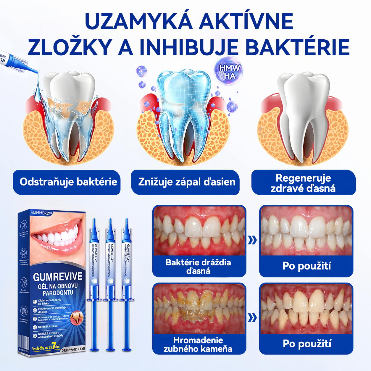 🇪🇺🏅🦷🛡️Evolvion® GumRevive Gél na periodontálnu opravu