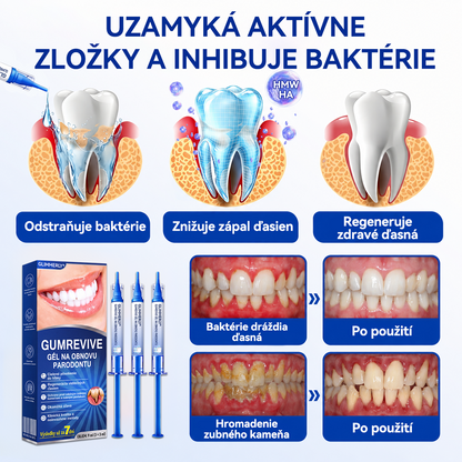 🇪🇺🏅🦷🛡️Evolvion® GumRevive Gél na periodontálnu opravu