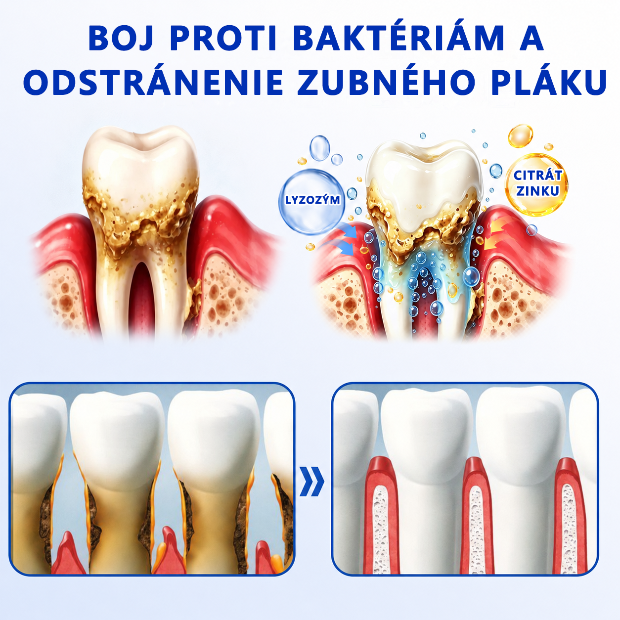 🇪🇺🏅🦷🛡️Evolvion® GumRevive Gél na periodontálnu opravu