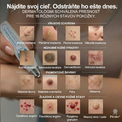 𝐎𝐟𝐢𝐜𝐢𝐚𝐥𝐧𝐲 𝐨𝐛𝐜𝐡𝐨𝐝 𝐦𝐚𝐫𝐤𝐲 | ✅️👩‍⚕️𝐏i𝐜𝐝o® 7dni Prípravok na odstránenie kožných výrastkov a pigmentových škvŕn (bezbolestný roll-on aplikátor bez jaziev) 🙏